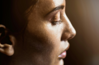 Radiesse May Be Tackling a Deeper Layer of Sun Damage, Study Finds